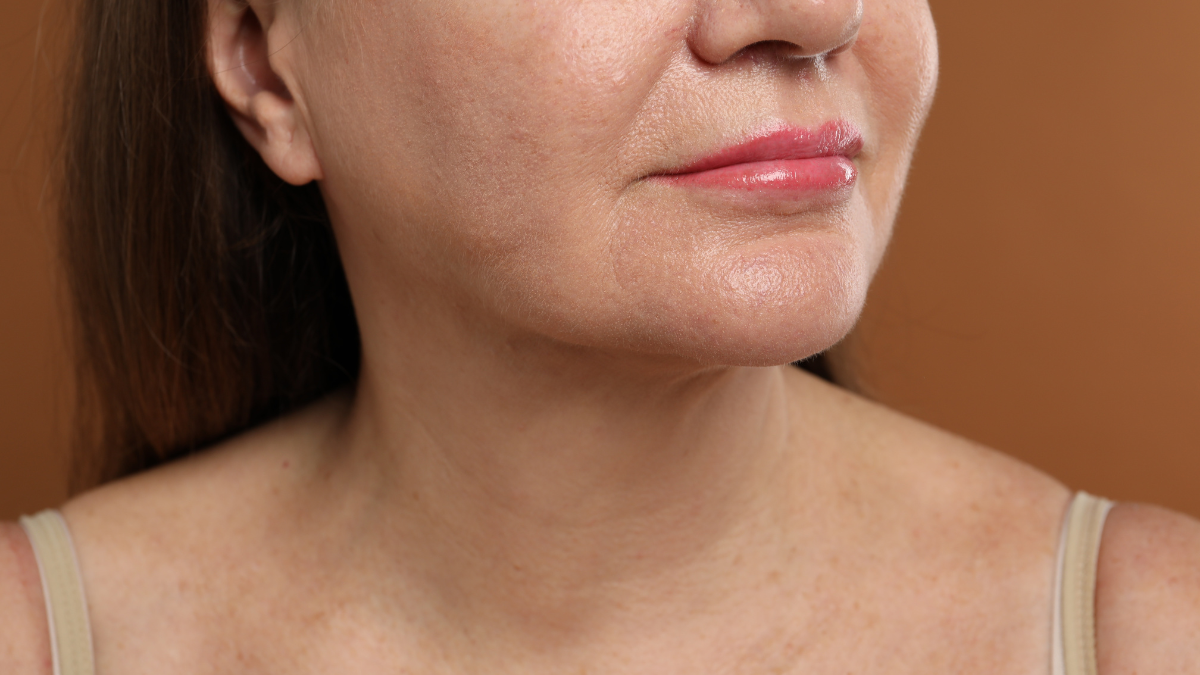 Contraindicaciones del lifting facial