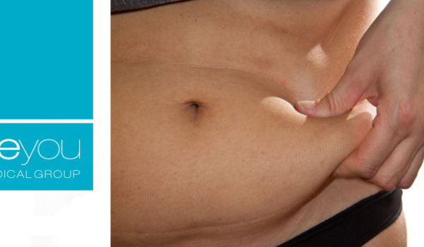 abdominiplastia-beyou-medical-group