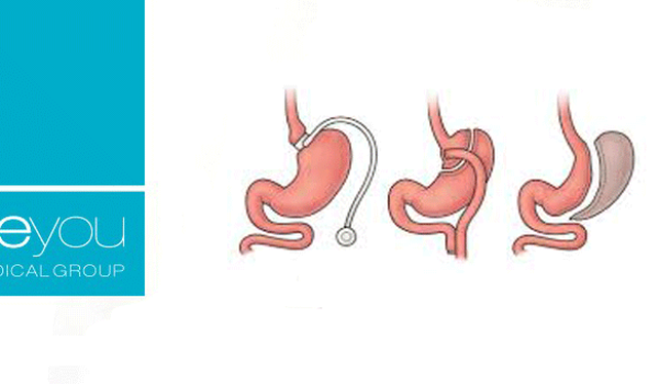 banda-bypass-manga-beyou