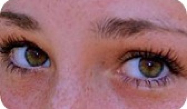 blefaroplastia-cirugia-parpados.jpg