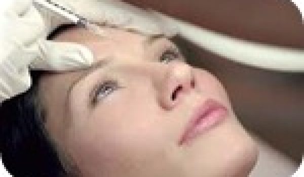 botox-patas-de-gallo.jpg