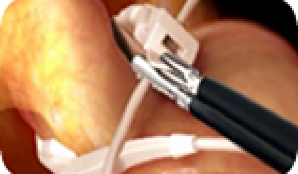 bypass-gastrico.png