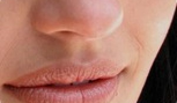 colageno-sculptra.jpg