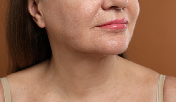 Contraindicaciones del lifting facial