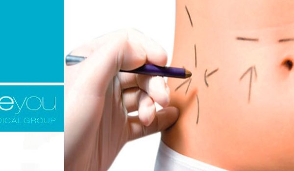 criolipolisis