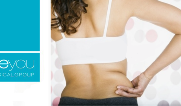 programa-remodelacion-corporal-beyou