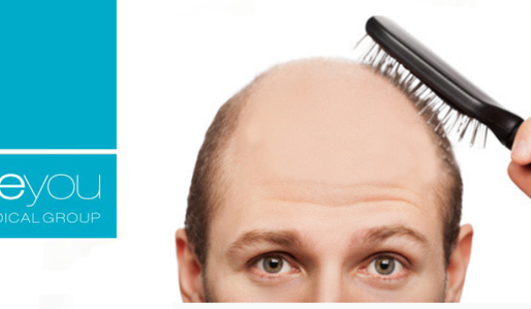 razones-injerto-capilar-beyou