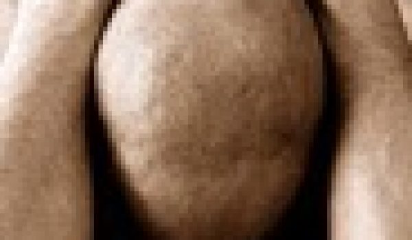 tratamientos-medicos-alopecia.jpg