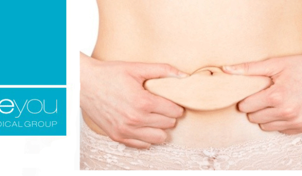 ventajas-balón-intragástrico-beyou